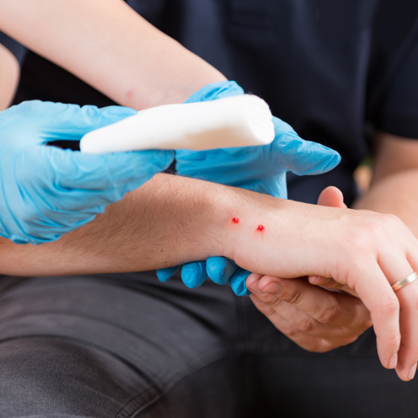 Do you have a personal injury claim if you were bitten by someone’s pet snake?